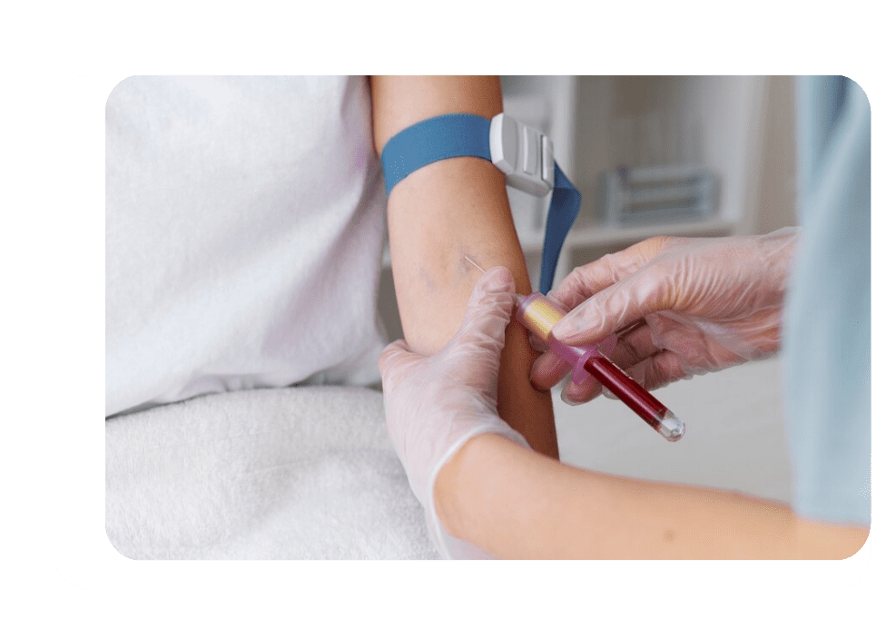 Laboratorio clinico a domicilio